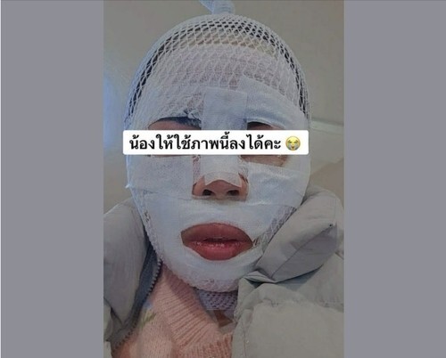 잠든 태국인 아내에게 끓는 물 부은 남편…항소심서 징역 감형 논란